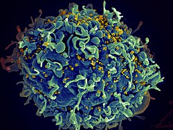 Scanning electron micrograph of a human H9 T cell infected with HIV virus particles